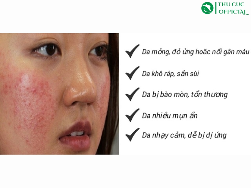Da nhạy cảm mỏng yếu