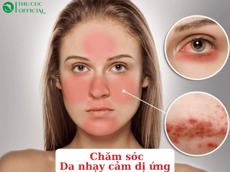 Da nhạy cảm mỏng yếu