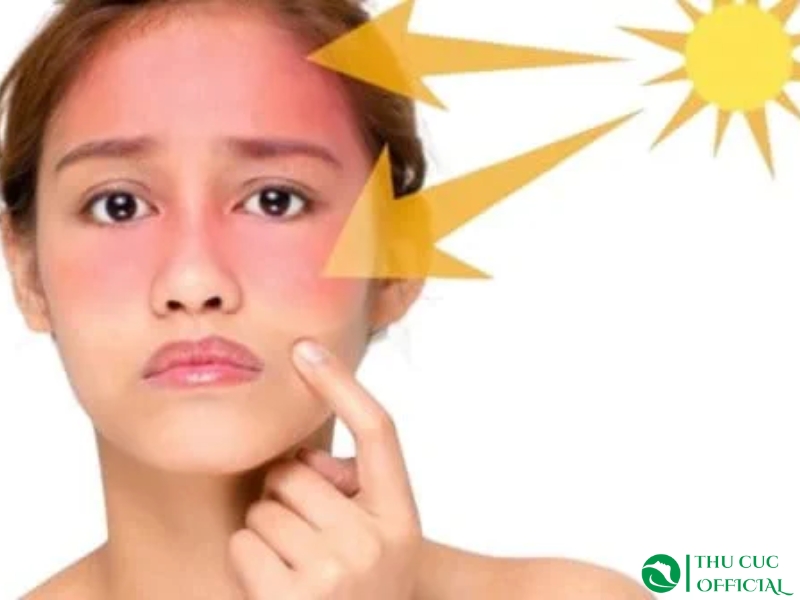 Chống nắng cho da nhạy cảm