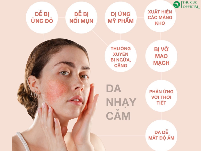 Đặc điểm của da nhạy cảm