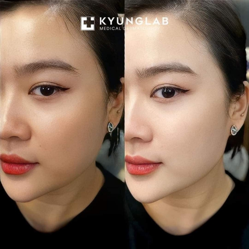Hiệu quả khi dùng kem dưỡng Kyung lab Day Cream 