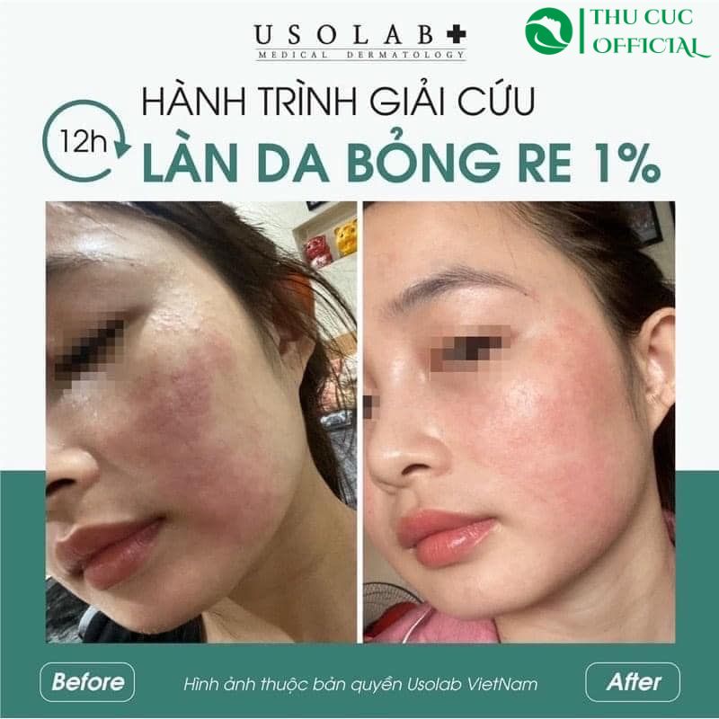 Hiệu quả sử dụng của kem K Usolab