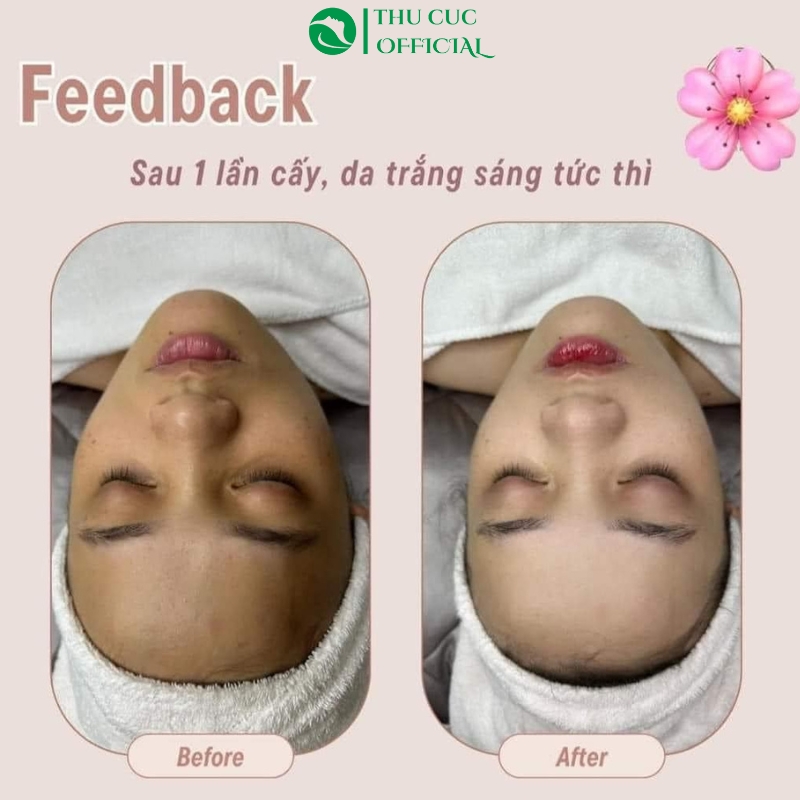 Hiệu quả ủ trắng với mặt nạ Histolab