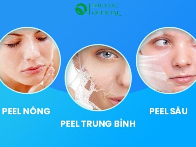 Ba cấp độ Peel da