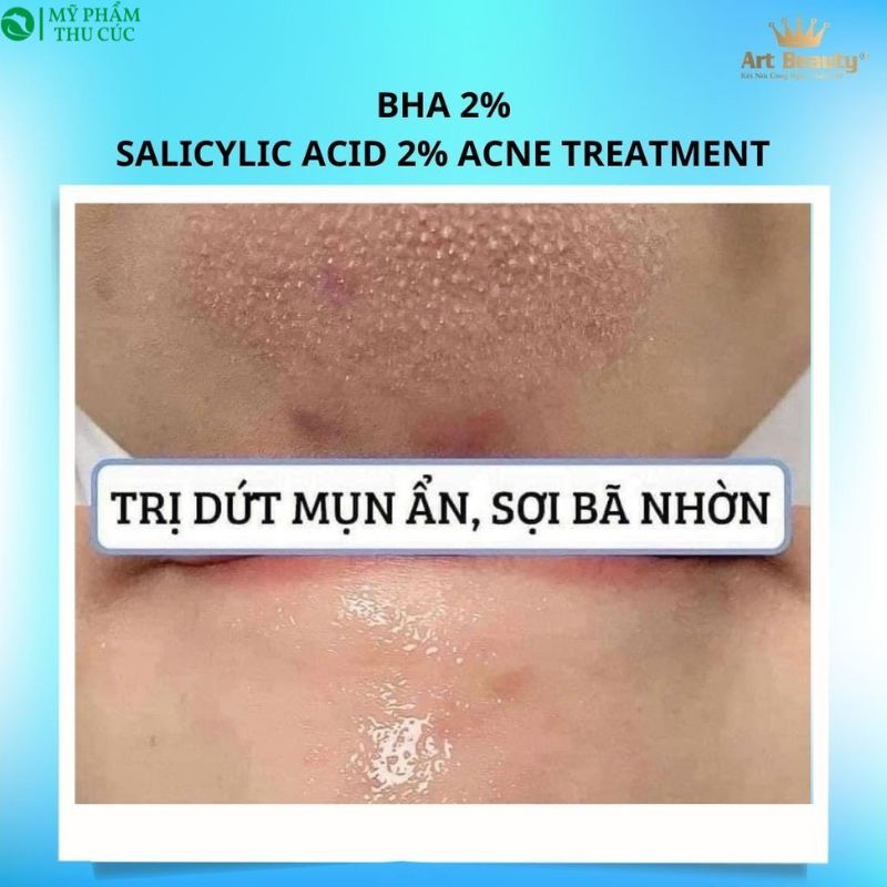 Toner BHA 2% Medic S Hàn Quốc