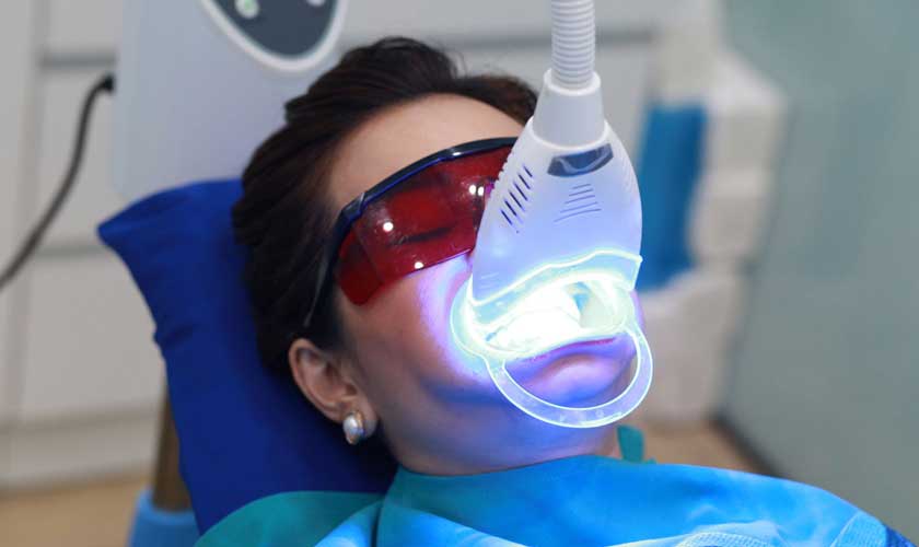 Tẩy trắng răng có hại không? Giải đáp chi tiết từ góc nhìn nha khoa