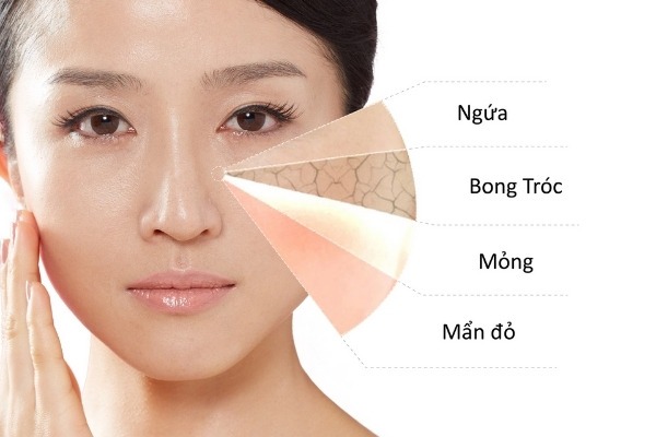 Các biện pháp chăm sóc da khô tại nhà