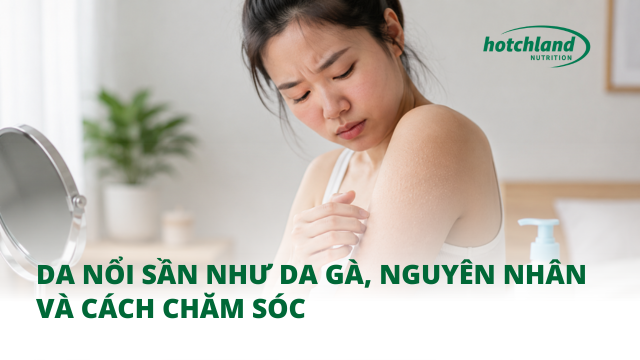 Da nổi sần như da gà, nguyên nhân và cách chăm sóc