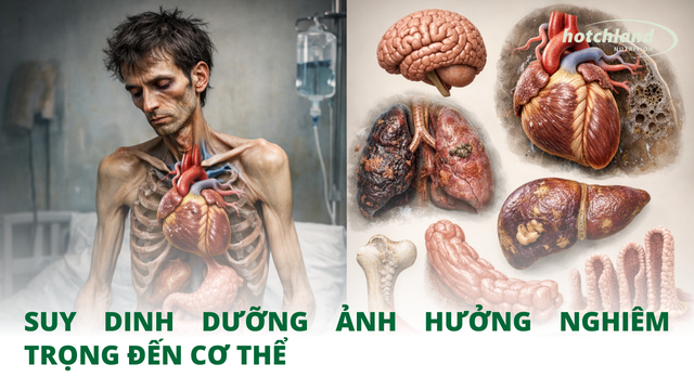 Suy dinh dưỡng ảnh hưởng nghiêm trọng đến cơ thể