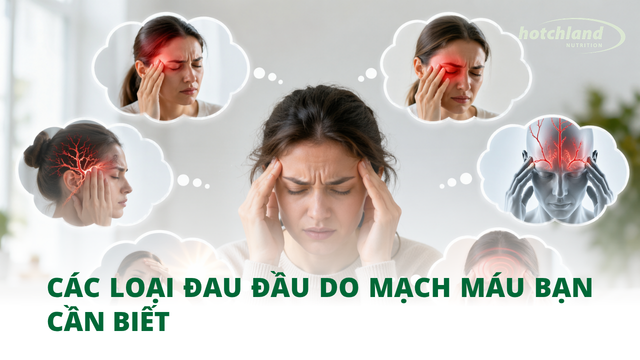 Các loại đau đầu do mạch máu bạn cần biết
