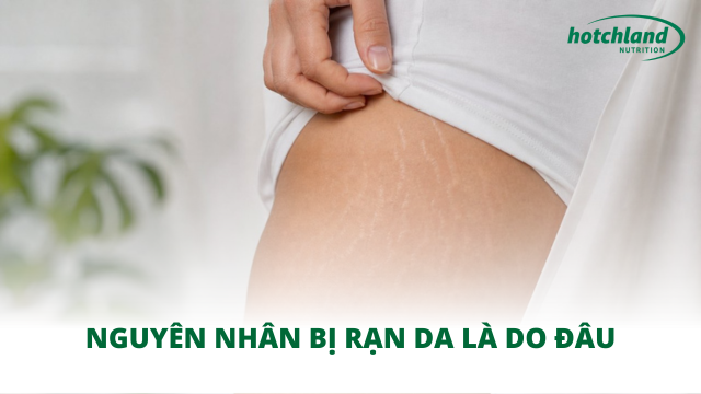Nguyên nhân bị rạn da là do đâu