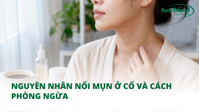 Nguyên nhân nổi mụn ở cổ và cách phòng ngừa