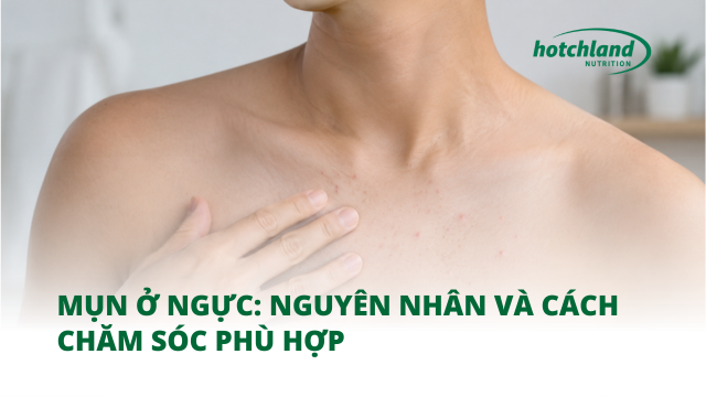 Mụn Ở Ngực: Nguyên Nhân Và Cách Chăm Sóc Phù Hợp