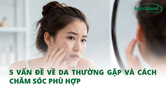 5 vấn đề về da thường gặp và cách chăm sóc phù hợp