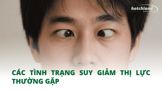 Các tình trạng suy giảm thị lực thường gặp