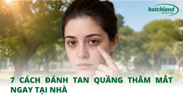 7 cách đánh tan quầng thâm mắt ngay tại nhà
