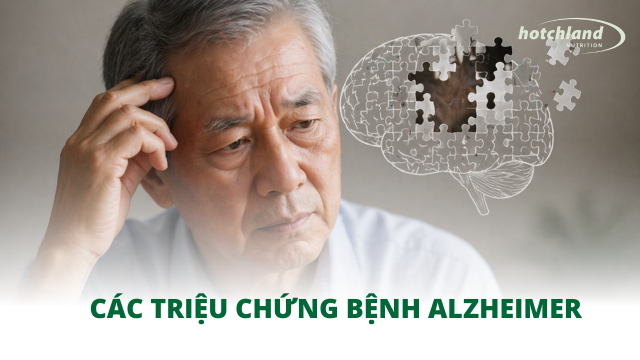 Các triệu chứng bệnh Alzheimer