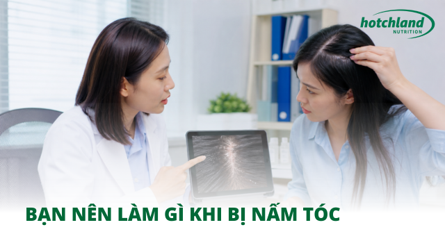 Bạn nên làm gì khi bị nấm tóc