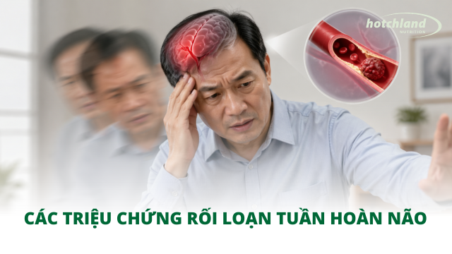 Các triệu chứng rối loạn tuần hoàn não