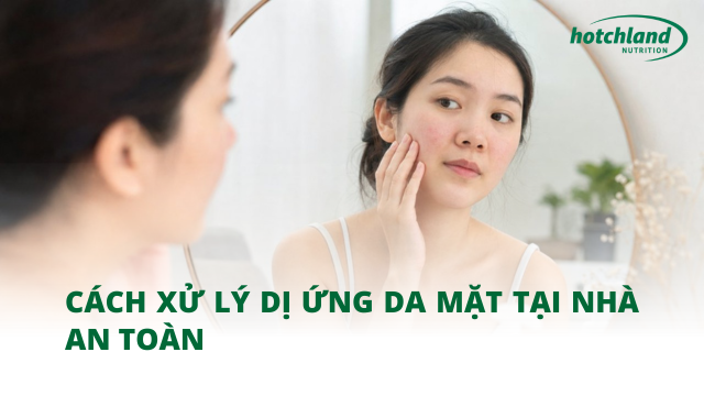 Cách xử lý dị ứng da mặt tại nhà an toàn