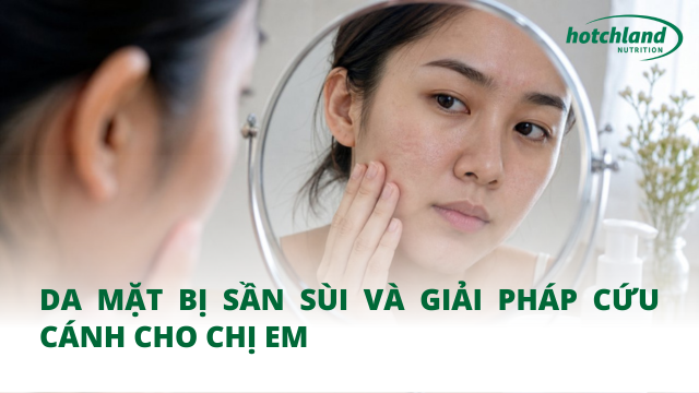 Da mặt bị sần sùi và giải pháp cứu cánh cho chị em