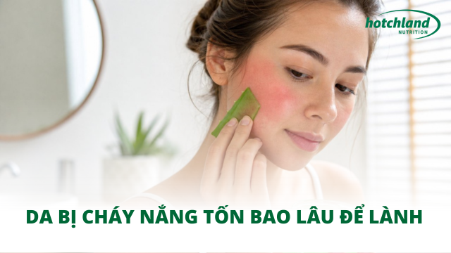 Da bị cháy nắng tốn bao lâu để lành