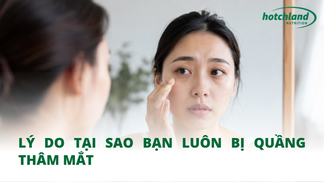 Lý do tại sao bạn luôn bị quầng thâm mắt