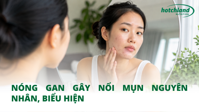 Nóng gan gây nổi mụn nguyên nhân, biểu hiện