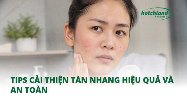Tips cải thiện tàn nhang hiệu quả, an toàn
