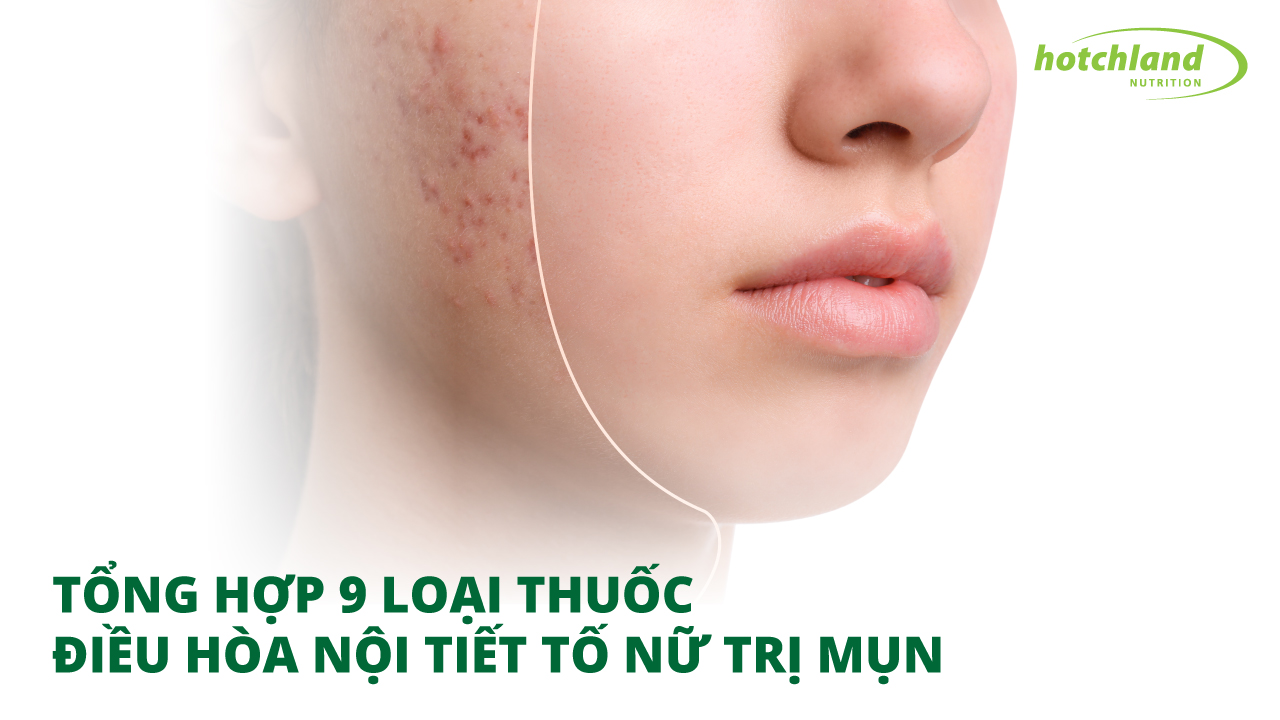 TỔNG HỢP 9 LOẠI THUỐC ĐIỀU HÒA NỘI TIẾT TỐ NỮ TRỊ MỤN MÀ CHỊ EM KHÔNG NÊN BỎ QUA