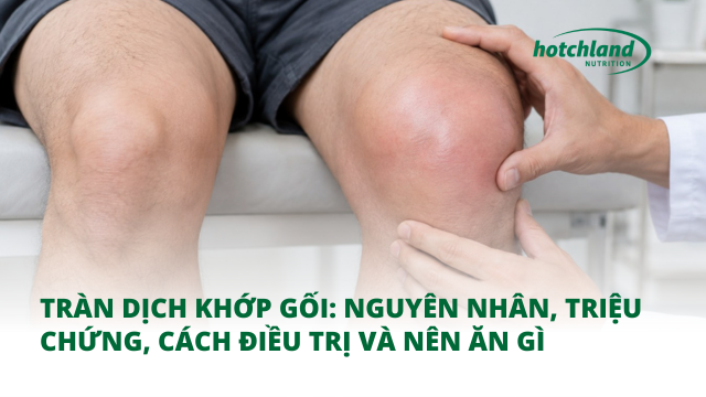 Tràn Dịch Khớp Gối: Nguyên Nhân, Triệu Chứng, Cách Điều Trị Và Nên Ăn Gì