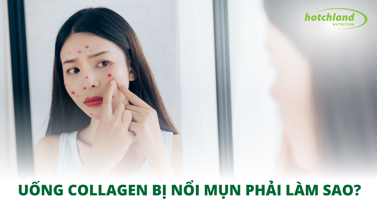 Uống Collagen bị nổi mụn phải làm sao? Lưu ý khi sử dụng