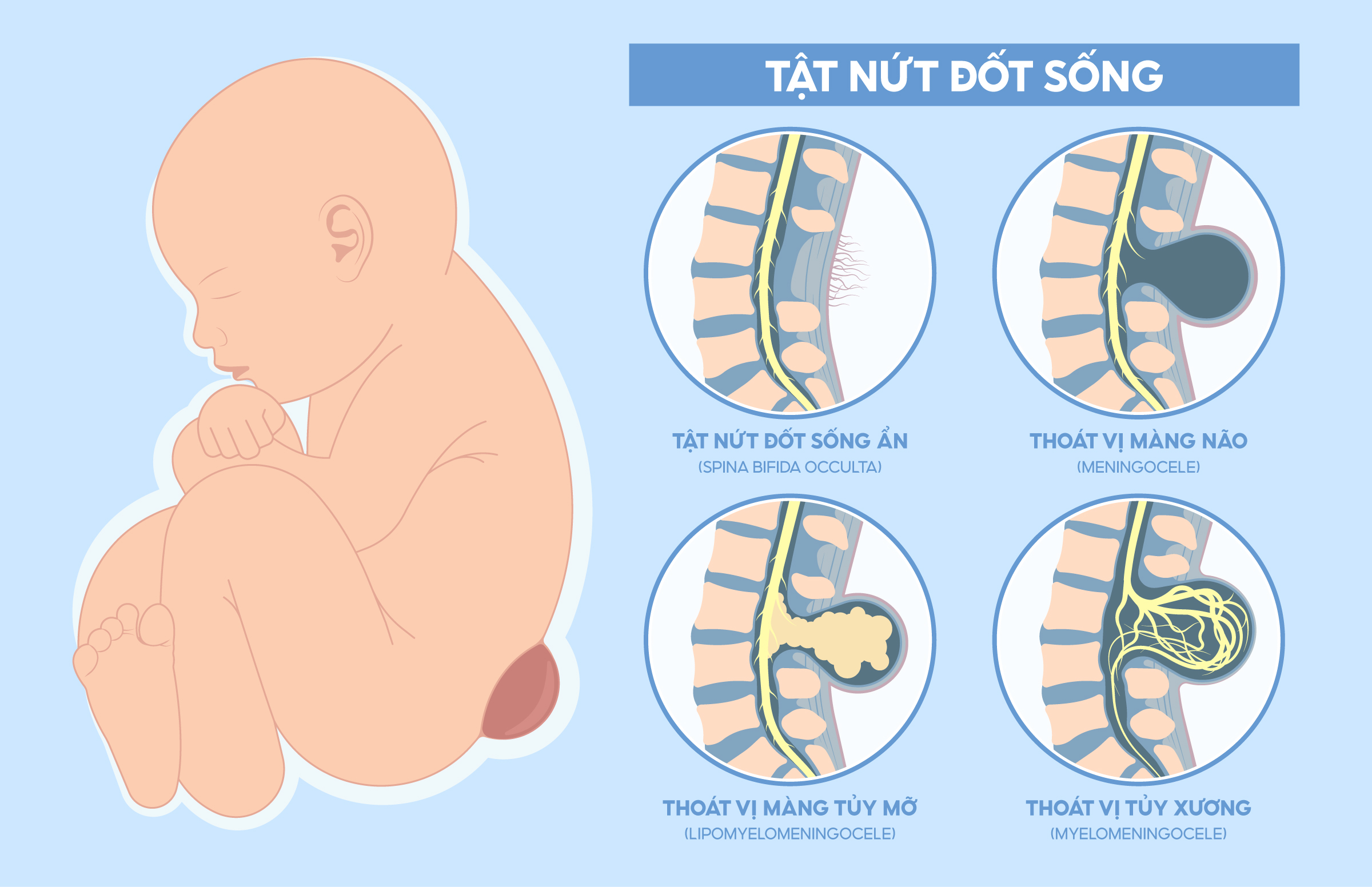 di-tat-nut-dot-song