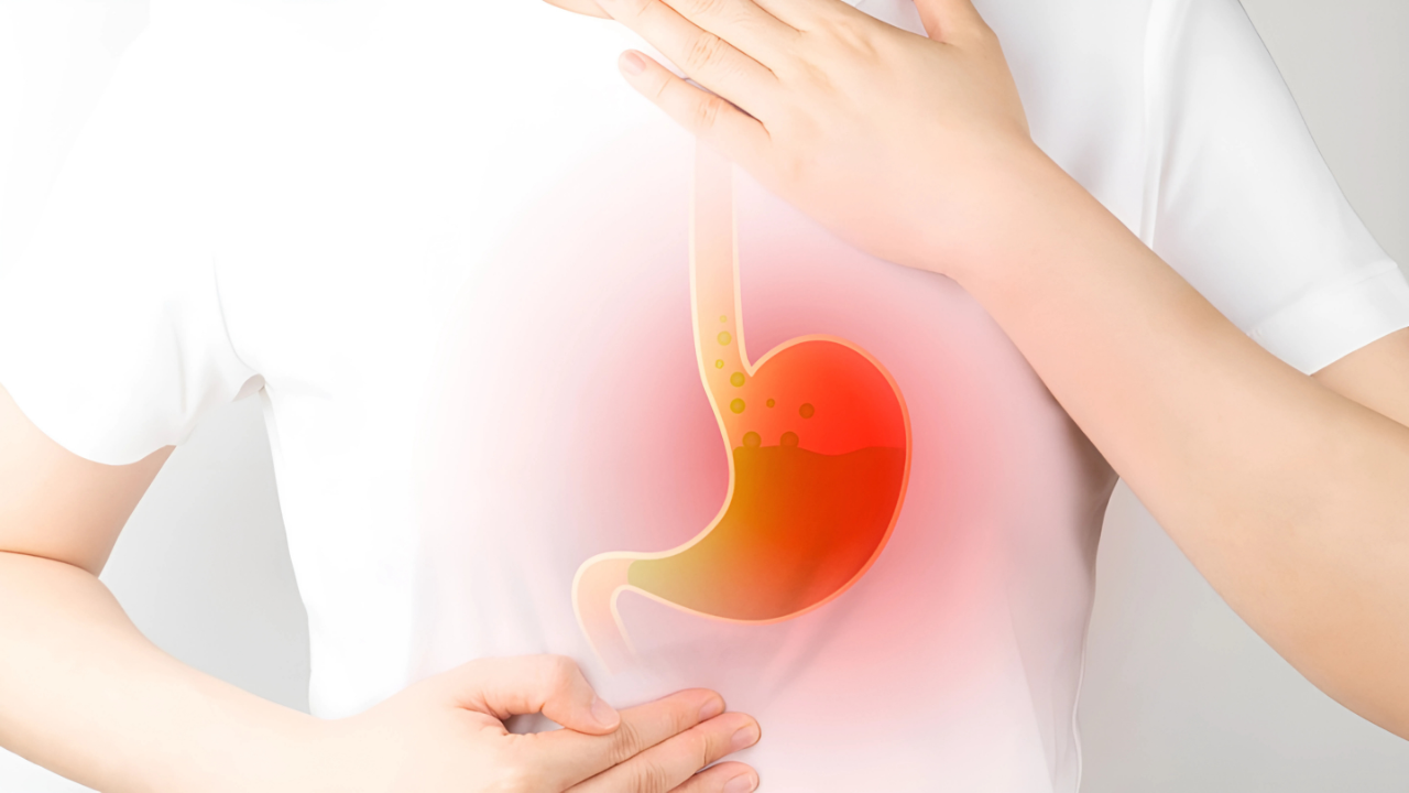 Ho Do Trào Ngược Dạ Dày - Nguyên Nhân, Triệu Chứng Và Cách Phòng Ngừa