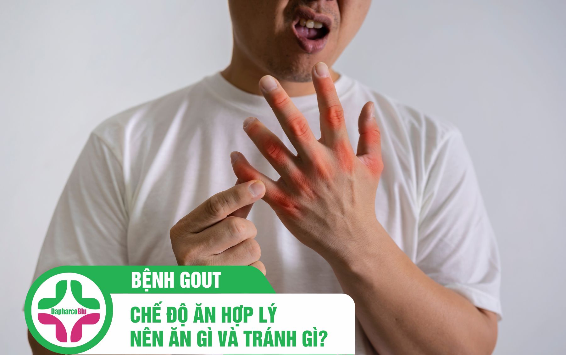 Chế Độ Ăn Hợp Lý Để Quản Lý Bệnh Gout: Nên Ăn Gì và Tránh Gì?