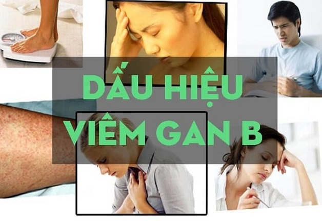 Viêm gan B là gì? Triệu chứng nhận biết bệnh?