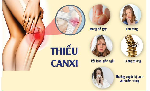 Những dấu hiệu cho thấy cơ thể bạn đang bị thiếu canxi trầm trọng