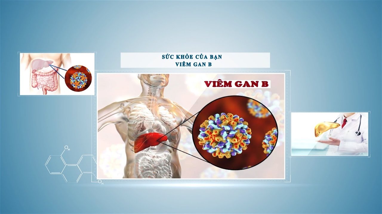 Viêm gan B và những điều bạn cần biết