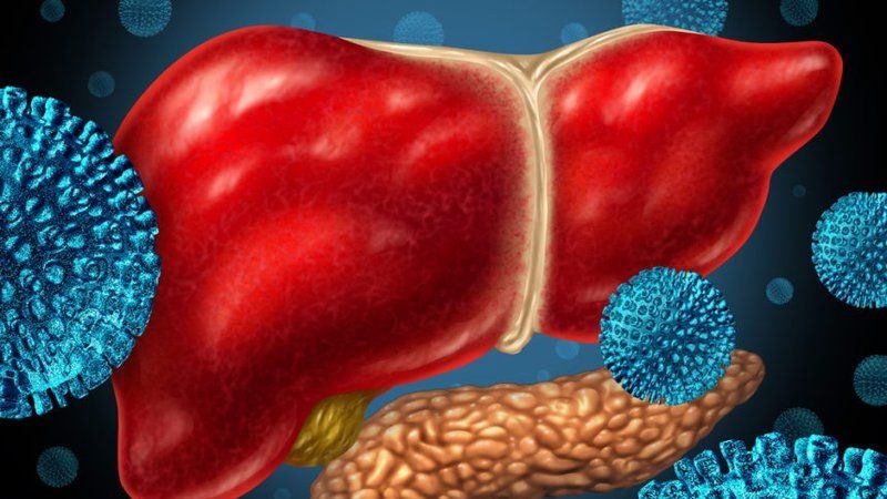 Viêm gan mãn tính: Nguyên nhân, triệu chứng và cách phòng bệnh