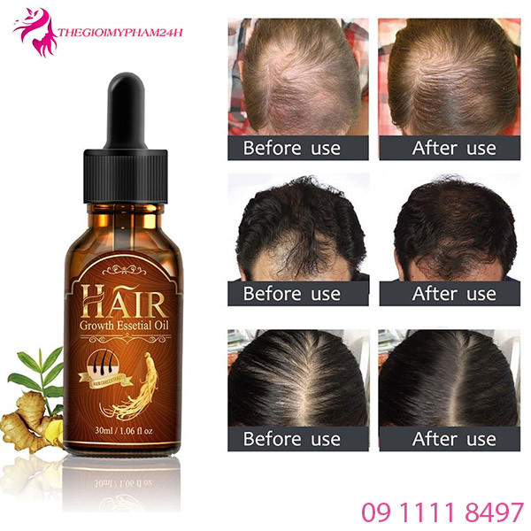 aliver hair growth essential oil -2