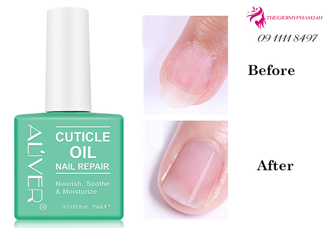 Dầu biểu bì Aliver Cuticle Oil Nail Repair có tốt không