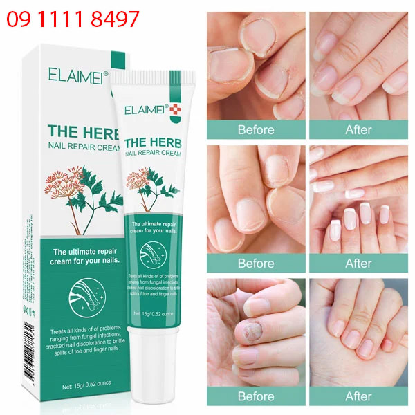 elaimei the herb nail repair cream-2