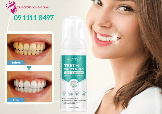 Kem đánh răng làm trắng răng Aliver hương trái cây Aliver Teeth Whitening Foaming là gì