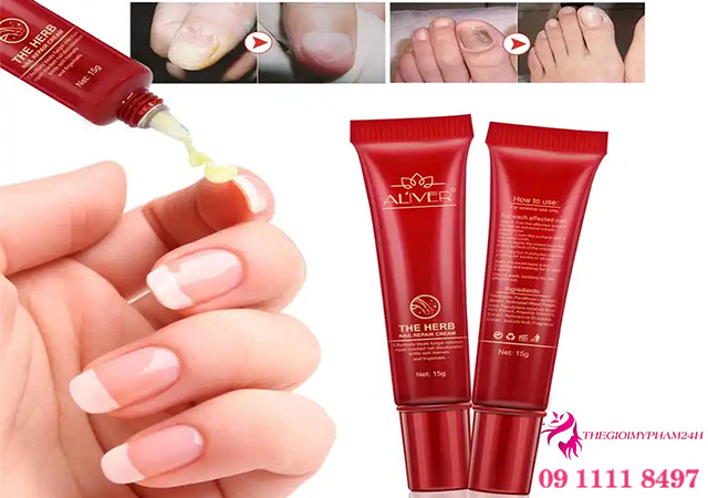 Kem dưỡng móng tay Aliver The Herb Nail Repair là gì