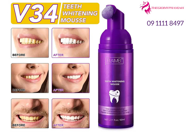 Tinh chất giúp trắng răng tự nhiên, không ê buốt Elaimei V34 Teeth Whitening Mousse có tốt không