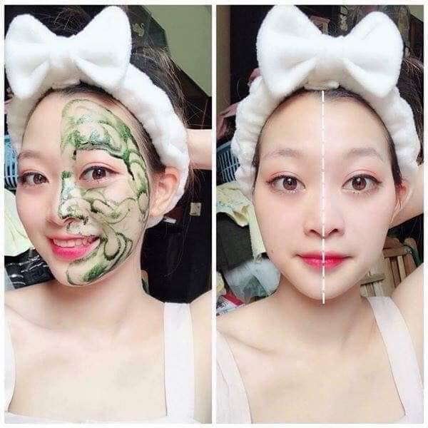 Cấy Tảo Cho Spa: Bộ Sản Phẩm & Giải Pháp Chăm Sóc Da | Nanocee