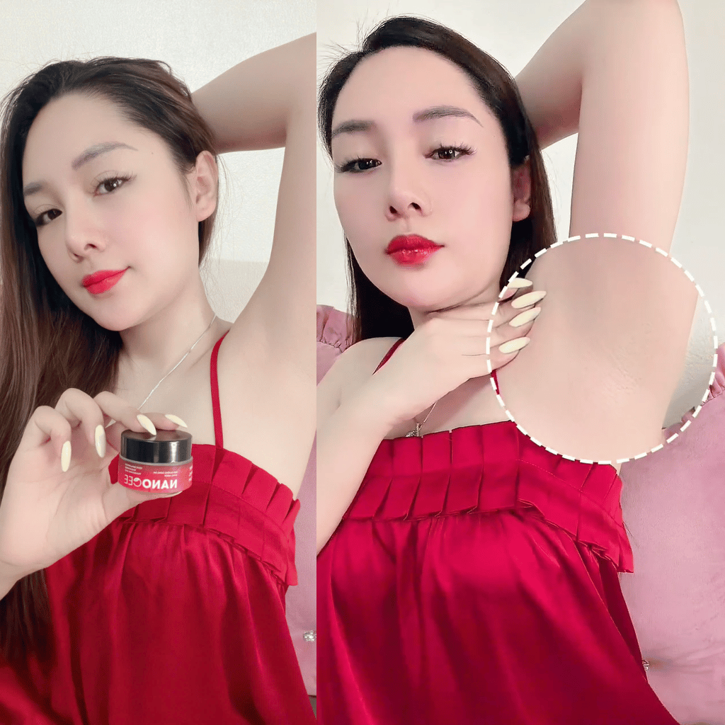 Kem Nách Nanocee Bà Bầu Dùng Được Không? Giải Đáp Từ Góc Nhìn Chăm Sóc Da
