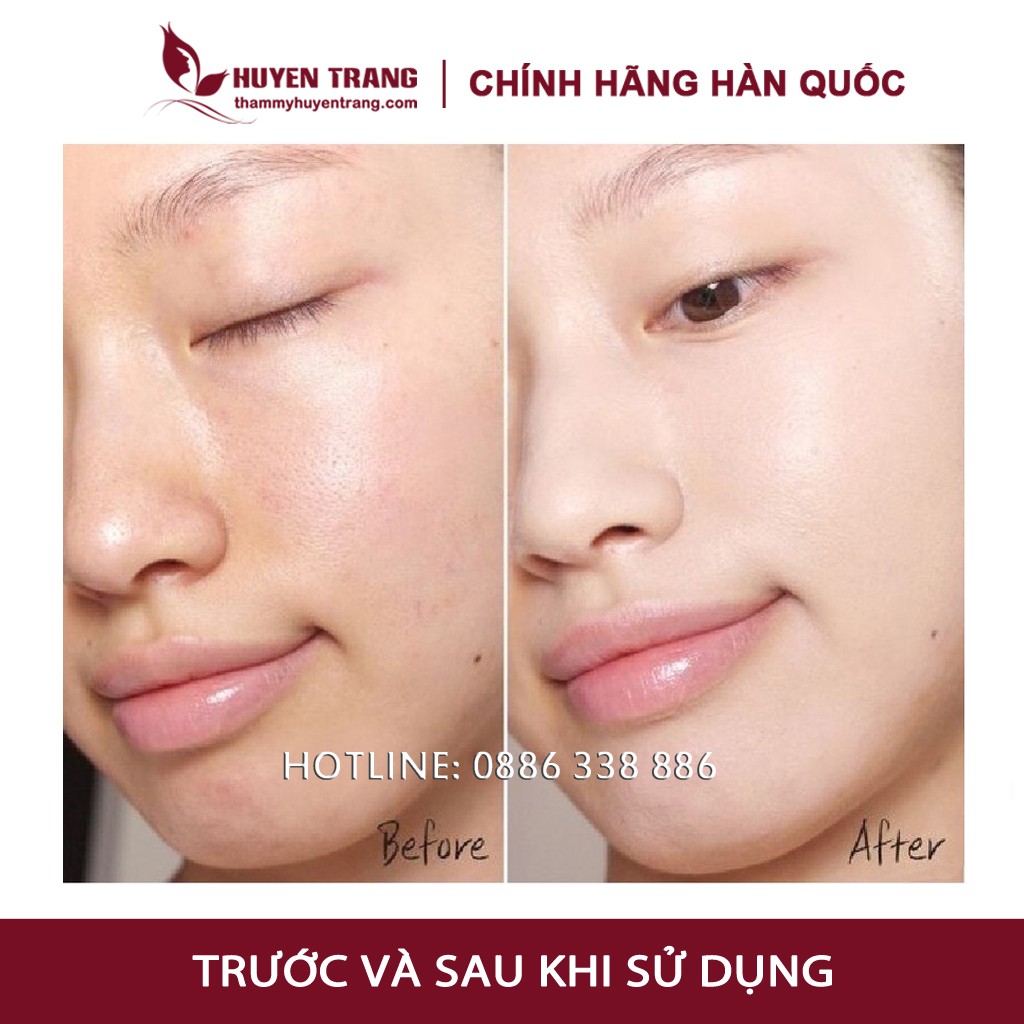 Tế Bào Gốc Hàn Quốc CUTISCURA Trắng Da (10ml/lọ) - Thẩm Mỹ Huyền Trang NANOCEE