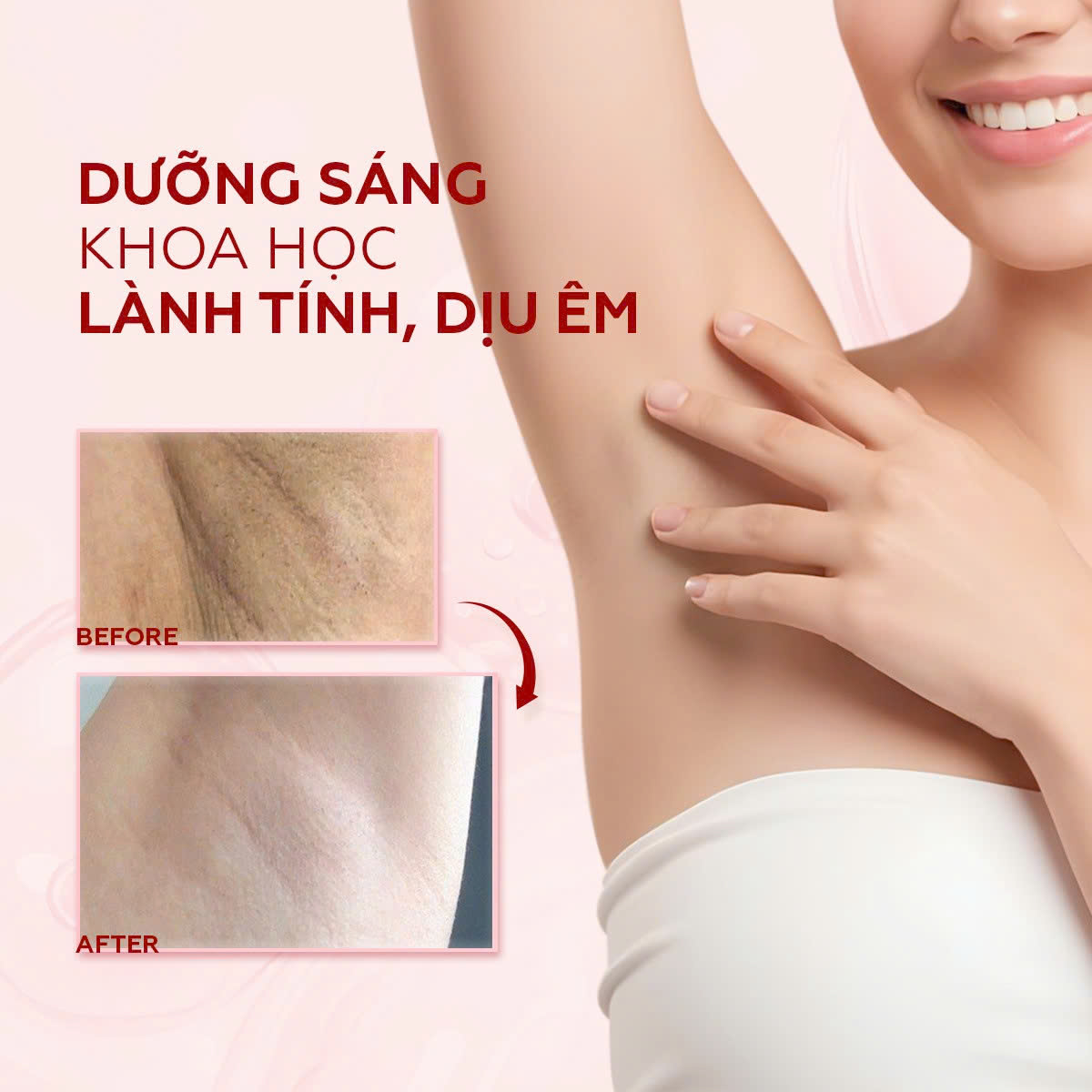 Kem trị thâm nách NANOCEE Underarm Brightening Cream – Giải pháp cải thiện thâm sạm vùng nách hiệu quả, an toàn