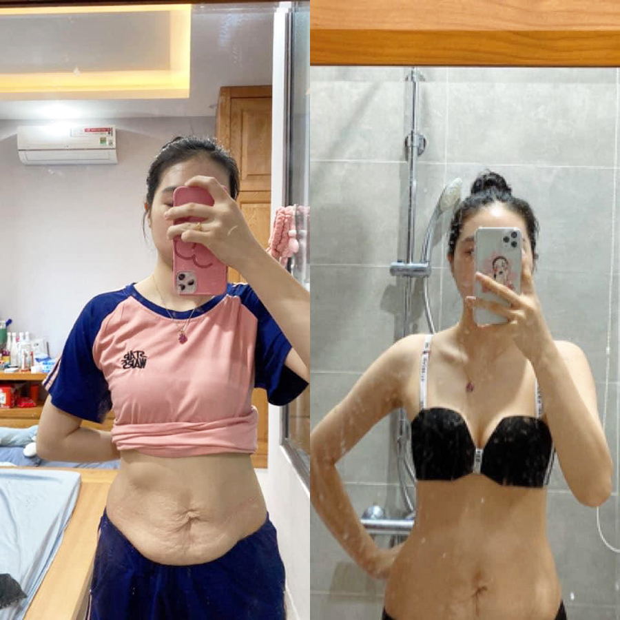 Đai Quấn Nóng Rung Massage – Làm Nóng Nhanh, Hỗ Trợ Chăm Sóc Body